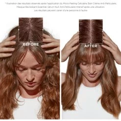 Bain Crème Anti-pelliculaire Symbiose Kérastase 250ML 13 Bain Crème Anti-pelliculaire Symbiose Kérastase 250ML -Magasin de beauté bain creme anti pelliculaire symbiose kerastase 250ml 2