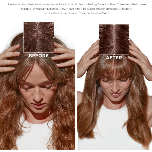 Bain Crème Anti-pelliculaire Symbiose Kérastase 250ML 5 Bain Crème Anti-pelliculaire Symbiose Kérastase 250ML – Image 3