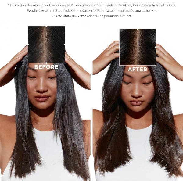 Micro-peeling Cellulaire Symbiose Kérastase 200ML 5 Micro-peeling Cellulaire Symbiose Kérastase 200ML – Image 3